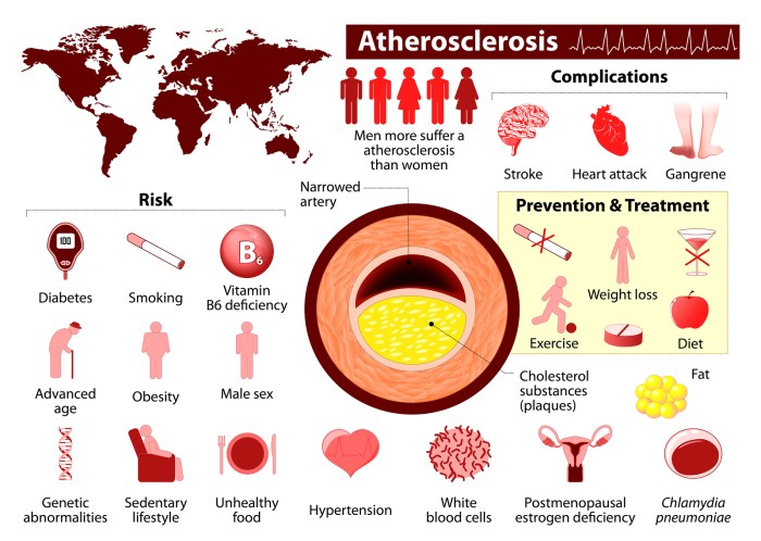 Peripheral vascular osmosis nclex