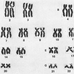 Karyotyping activity answer key pdf