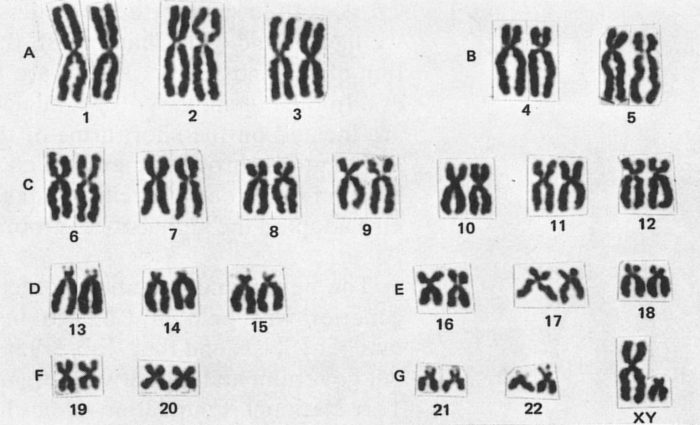 Karyotyping activity answer key pdf