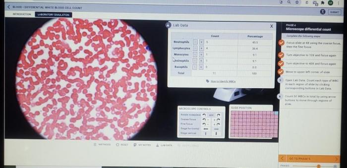 Differential white blood cell count lab mcgraw hill