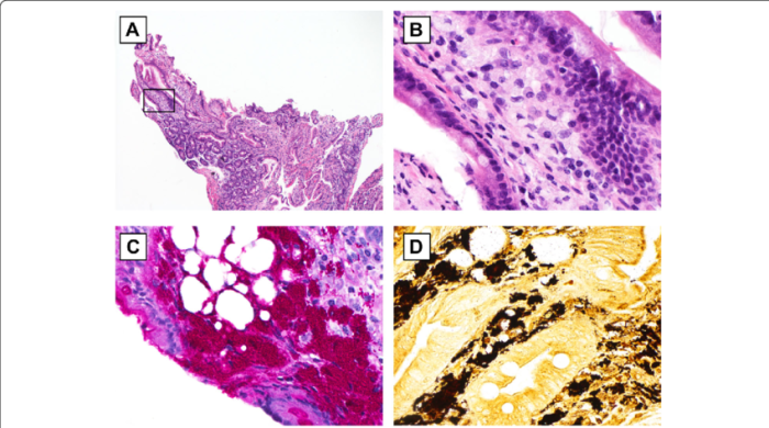 Fat milk globule membrane casein micelles sem native globules constituents cryo whey rsc indicate small protein pubs